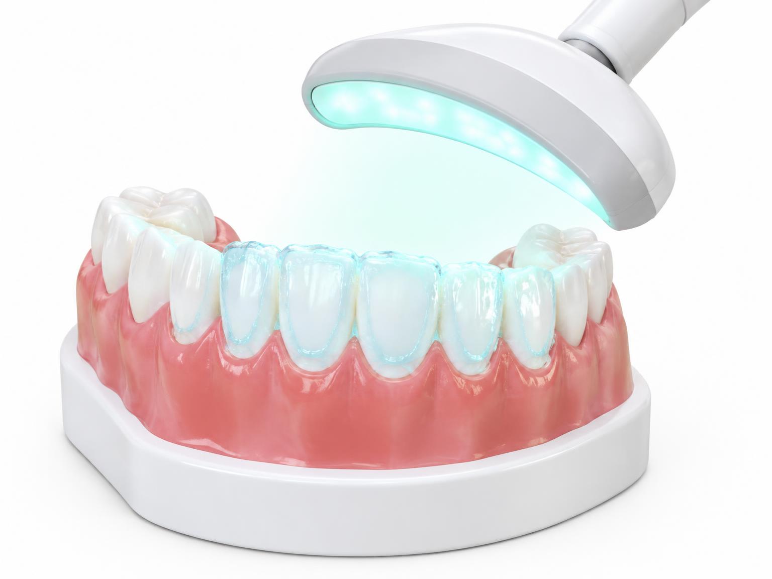 Illustration of whitening gel on front teeth under a whitening lamp